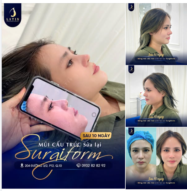 Dáng Mũi Mới - Niềm Vui Mới