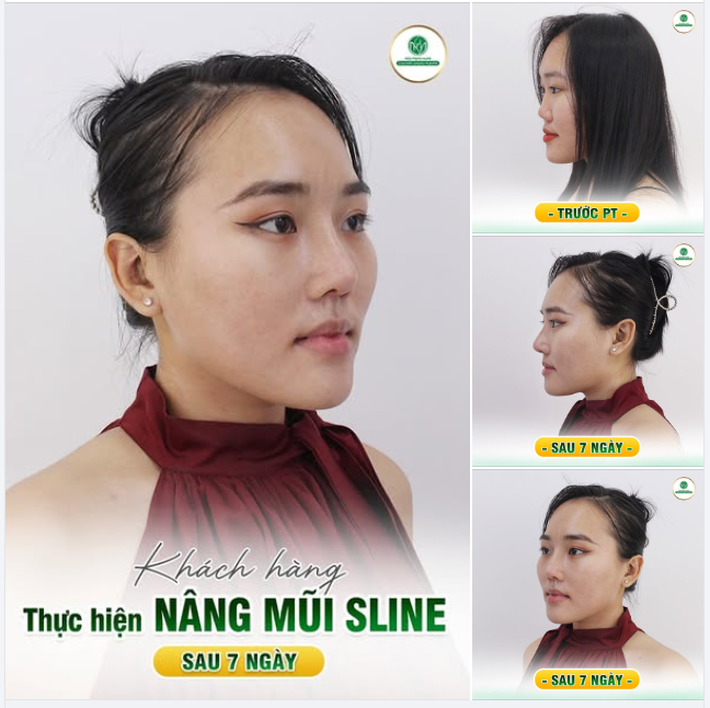 MỖI NGÀY LÀ MỘT CƠ HỘI ĐỂ ĐẸP HƠN
