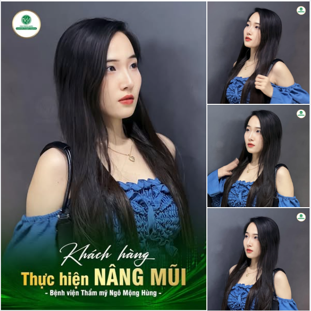 ĐỘNG LỰC NÂNG MŨI NGÀY ĐẦU TUẦN