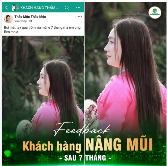 KH SAU 7 THÁNG NÂNG MŨI NÓI GÌ?