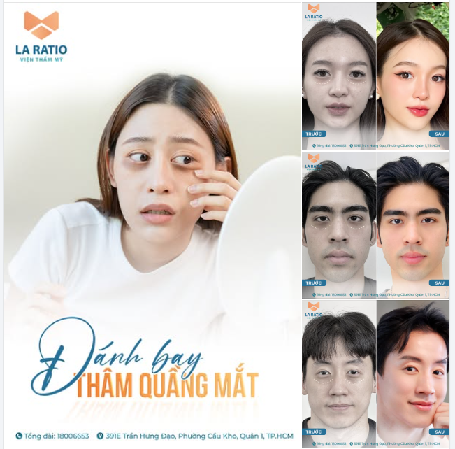 THÂM QUẦNG MẮT do thức khuya, do bẩm sinh, do dùng điện thoại - máy tính mang ánh sáng xanh, do nội tiết tố... giờ đây đã có cách giải quyết.