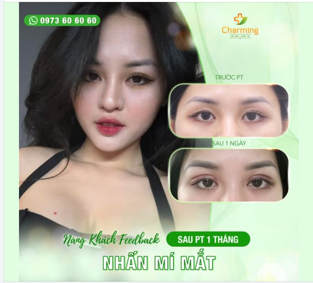 Nàng khách đáng yêu của chúng ta đã quyết định nhấn mí để cải thiện đôi mắt, giúp ánh nhìn thêm phần sắc sảo nhưng vẫn giữ được sự tự nhiên.