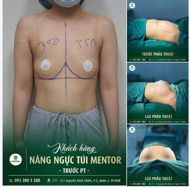 ĐIỂM NÀO TRÊN CƠ THỂ KHIẾN CHỊ EM CHƯA HÀI LÒNG?