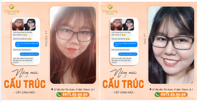 Mũi đẹp tự nhiên, đeo kính thần thái, thêm chút tươi tắn là auto cuốn hút mọi ánh nhìn. Cảm ơn nàng vì đã tin tưởng Charming và lan tỏa năng lượng tích cực như thế này nha
