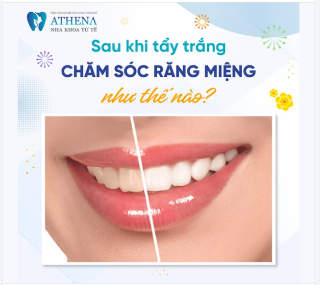 Tẩy trắng răng là một phương pháp hiệu quả giúp bạn có một nụ cười sáng bóng và tự tin hơn.