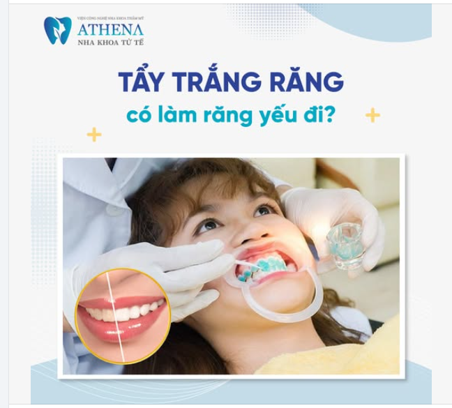 Đây là thắc mắc của rất nhiều người khi muốn cải thiện màu sắc răng.
