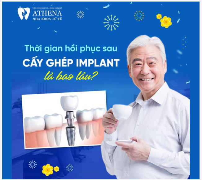 Thời gian hồi phục sau cấy ghép Implant sẽ phụ thuộc vào nhiều yếu tố
