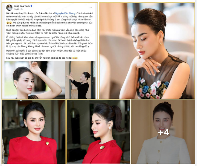 Đôi dòng Feedback chia sẻ từ Cô giáo Đặng Bảo Trâm vì quá hài lòng về kết quả tái ph.ẫu th.uật mũi cấu trúc lần thứ 2 sau 4 năm rưỡi nhìn lại.