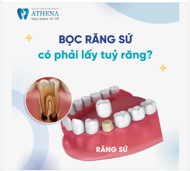 Đây là một câu hỏi rất nhiều người quan tâm khi tìm hiểu về bọc răng sứ.