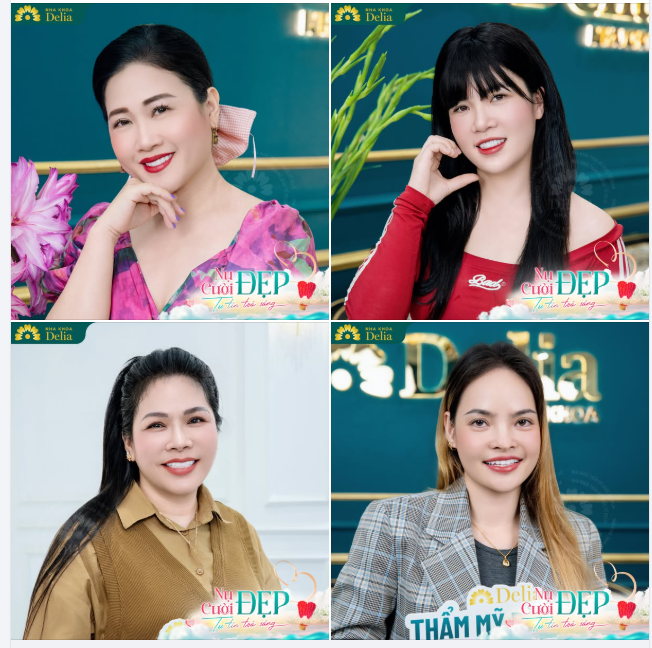 Kết quả xinh đẹp của các chị khách hàng sau 48 giờ hoàn thiện thẩm mỹ răng sứ tại Delia!