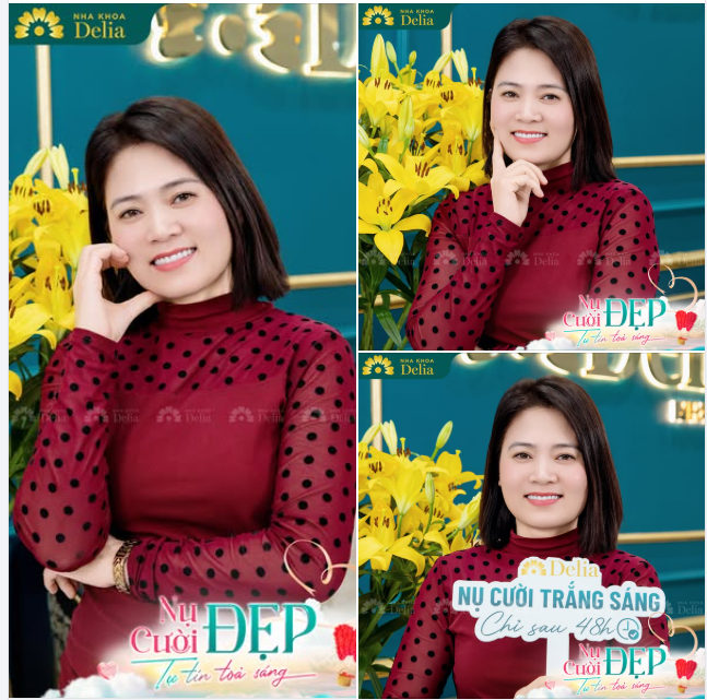 "Hối hận thật rồi! Hối hận vì không đi làm răng sứ sớm hơn"