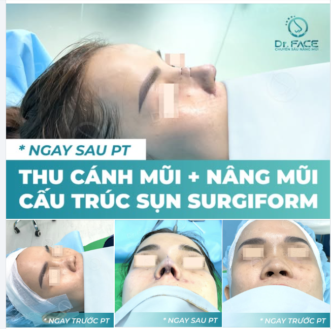 Theo bạn, đây là CÙNG MỘT NGƯỜI hay HAI NGƯỜI KHÁC NHAU?