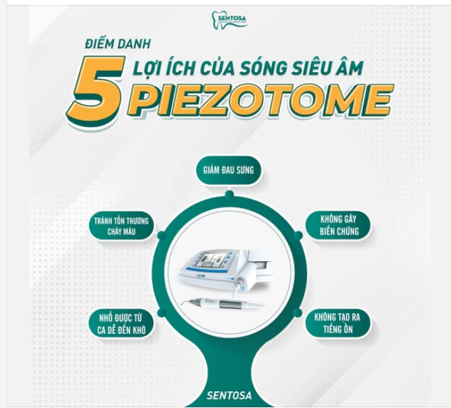 ĐIỂM DANH 5 LỢI ÍCH CỦA SÓNG SIÊU ÂM PIEZOTOME TRONG NHỔ RĂNG KHÔN