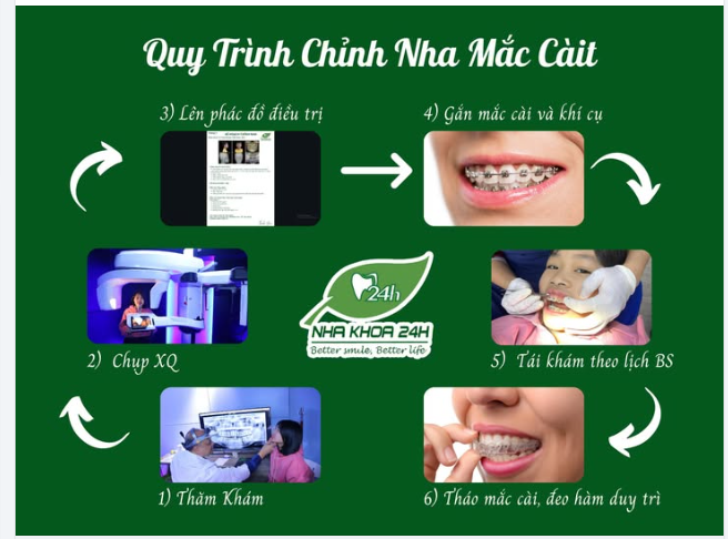 QUY TRÌNH CHỈNH NHA HIỆN ĐẠI TẠI NHA KHOA 24H – KIẾN TẠO NỤ CƯỜI HOÀN HẢO
