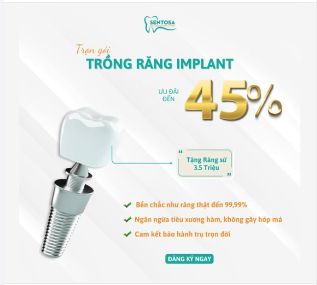 SIÊU ƯU ĐÃI TRỒNG RĂNG IMPLANT GIẢM ĐẾN 45% TRỌN GÓI