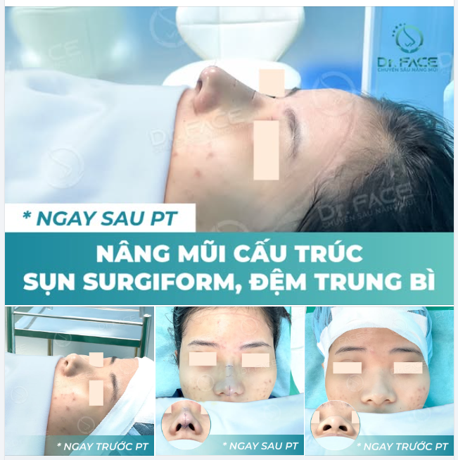 CẦN MỘT CHÚT XINH ĐẸP? CÓ NGAY!