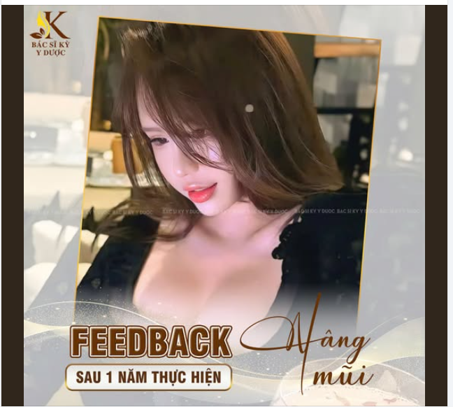 NÂNG MŨI ALINE - SẮC NÉT TỪNG ĐƯỜNG NÉT