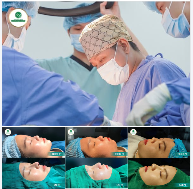 MUỐN CÓ MŨI ĐẸP KHÔNG KHÓ Vì mọi chuyện khó đã có BVTM Ngô Mộng Hùng lo!