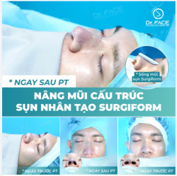 ĐÂY GỌI LÀ KHÁC BIỆT HOÀN HẢO…