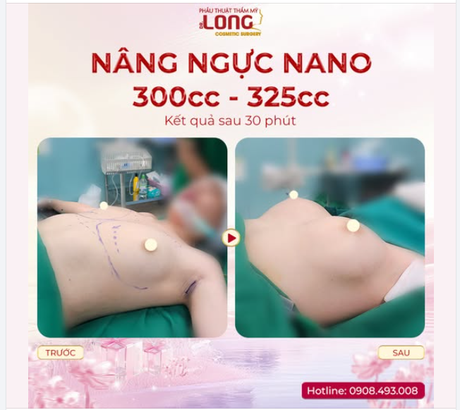 GIẢI PHÁP CỨU RỖI VÒNG 1 KHÔNG CÂN XỨNG  NÀNG NÀO LỆCH SIZE VÀO ĐÂY XEM KẾT QUẢ