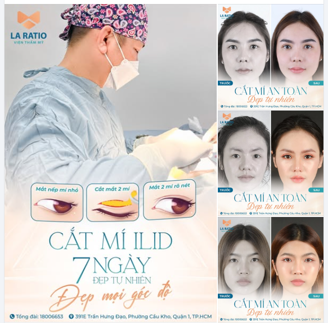 "LỘT XÁC" XINH ĐẸP SAU 7 NGÀY CẮT MÍ ILID
