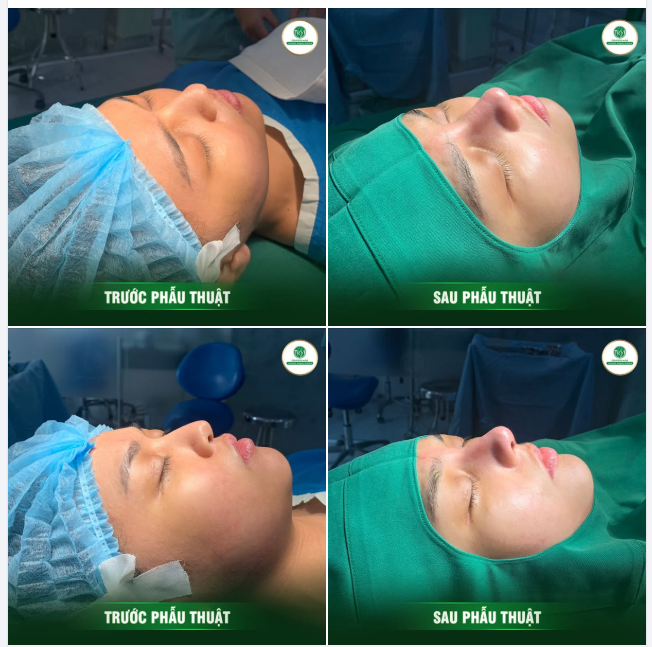 Ở ĐÂY CÓ DÁNG MŨI CỰC SANG