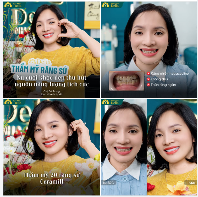 "40 năm mang nụ cười tối, xỉn màu, tôi nhận ra đã đến lúc phải thay đổi để trước hết tự tin hơn, và phục vụ công việc mới sắp tới." - Chia sẻ của chị Đỗ Trang (đến từ Hoài Đức, Hà Nội)