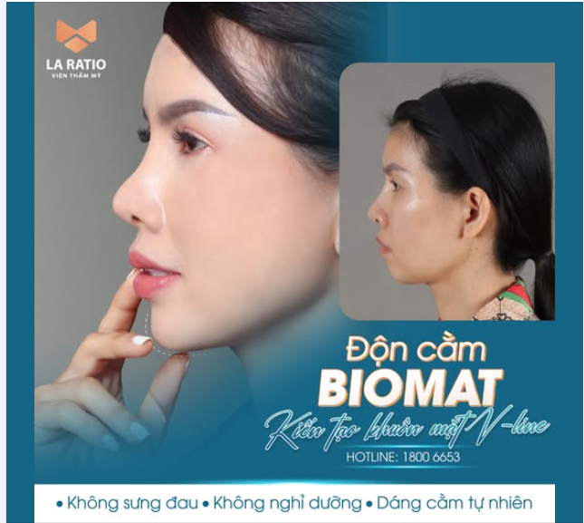 Độn cằm là phương pháp giải quyết mọi khuyết điểm: Cằm ngắn, cằm lẹm, cằm lệch thiếu cân đối.