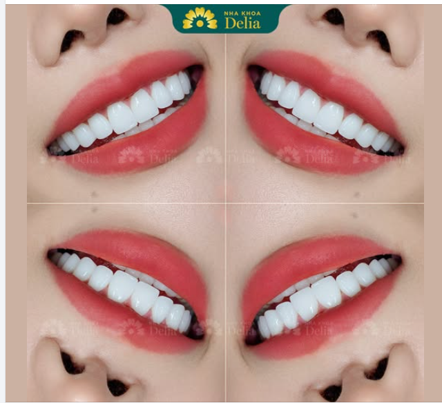 Chỉ 48 giờ, có ngay nụ cười khỏe đẹp, tự tin sống trọn từng khoảnh khắc.