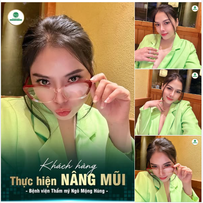 “THĂNG HẠNG” NHAN SẮC HẬU NÂNG MŨI