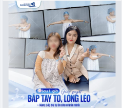 SAU 1 GIỜ GIẢI QUYẾT BẮP TAY TO, LỎNG LẺO