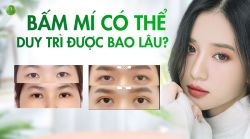 PHƯƠNG PHÁP BẤM MÍ CÓ THỂ DUY TRÌ ĐƯỢC BAO LÂU?