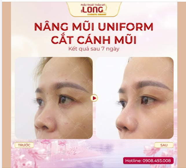 “ĐẸP THẬT” CHẤP CẢ CAMERA THƯỜNG