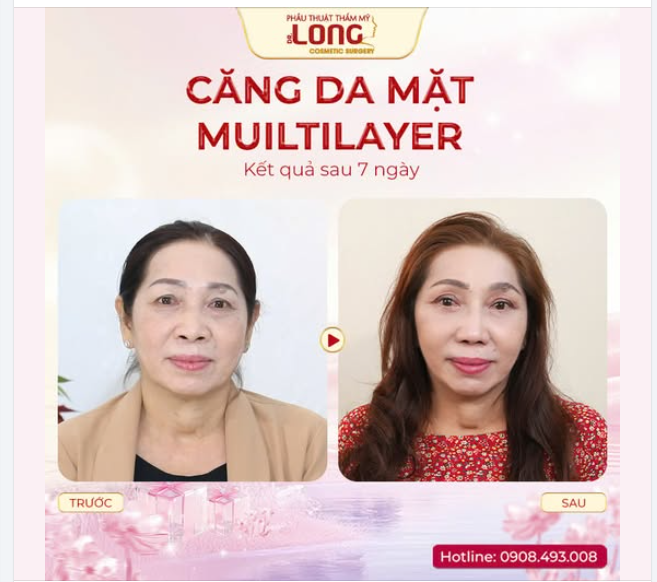 PHÁI ĐẸP LÊN NGÔI - ĐẶC QUYỀN NHÂN ĐÔI