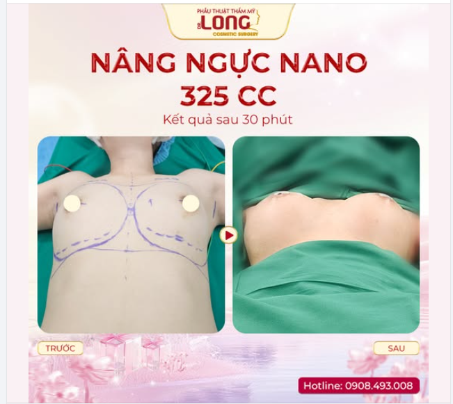 UPDATE BẢN THÂN - TÂN TRANG VÒNG 1