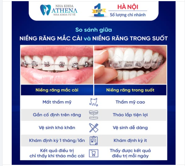 NIỀNG RĂNG – LỰA CHỌN NÀO PHÙ HỢP NHẤT CHO BẠN?