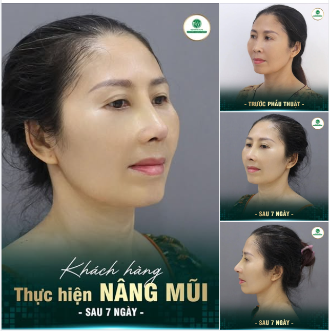 DÙ BẠN BAO NHIÊU TUỔI  Làm đẹp cũng chưa bao giờ là quá trễ