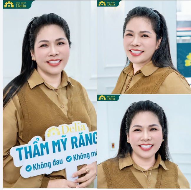 Chủ cửa hàng túi hiệu sở hữu nụ cười rạng rỡ với trọn bộ 20 răng sứ HT Smile cao cấp Đức