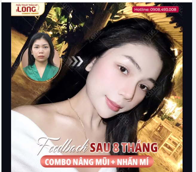VISUAL LÊN NGÔI CHỈ SAU VÀI THÁNG
