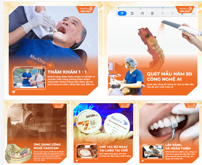 RĂNG SỨ 24H – CÓ THẬT SỰ CHỈ MẤT 1 NGÀY?