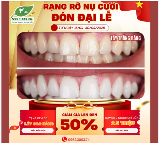 TẨY TRẮNG RĂNG – TỎA SÁNG RẠNG NGỜI MỪNG ĐẠI LỄ 30/4 - 1/5