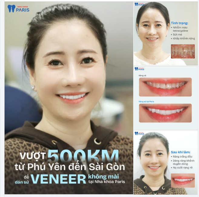 500km – Một chặng đường xứng đáng vì nụ cười trọn đời