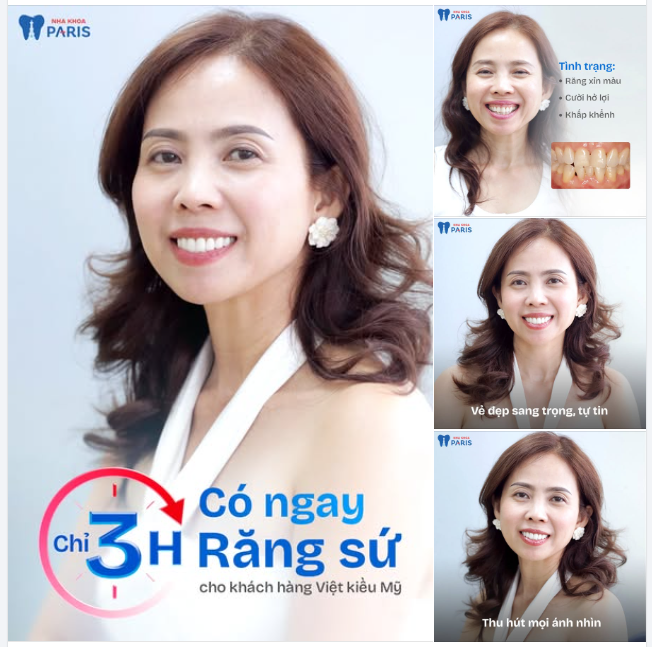 Chỉ sau 3 giờ - Thay đổi cả nụ cười và thần thái!