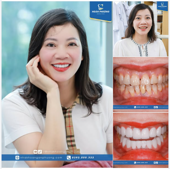 Sau tất cả, nụ cười đẹp là đích đến của hành trình rạng rỡ
