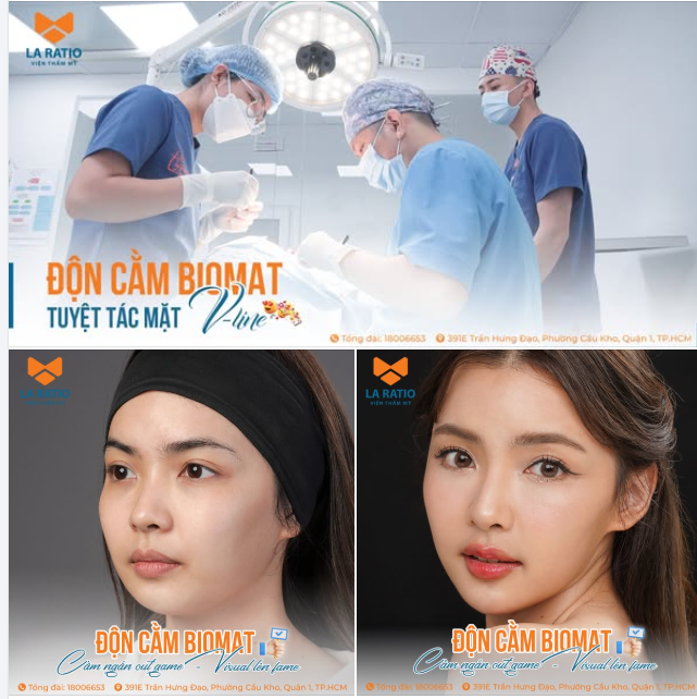 ĐỘN CẰM BIO MAT – TẠO ĐƯỜNG NÉT THANH THOÁT, KHÔNG LỘ DẤU VẾT