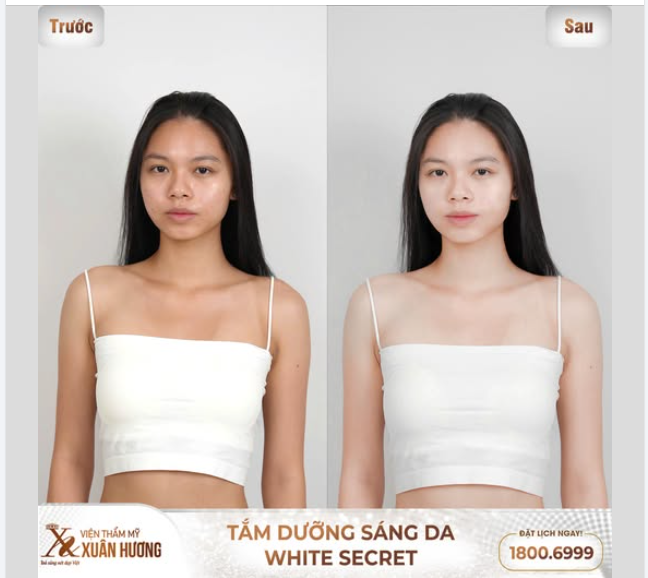 Da trắng xịn - Tự tin checkin hè này