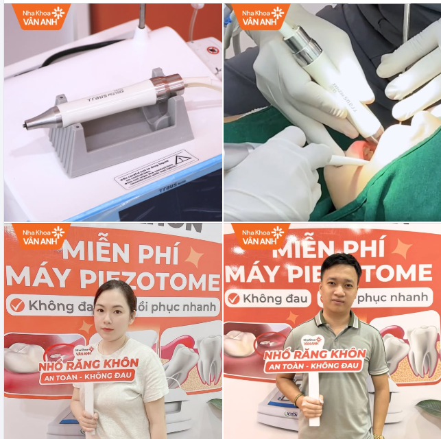 Piezotome – Công nghệ nhổ răng an toàn, không đau, lành thương nhanh – giải pháp an toàn cho mọi khách hàng