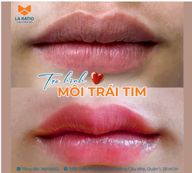 TẠO HÌNH MÔI – khi bạn chọn đẹp cho chính mình, chứ không phải để ai khác hài lòng