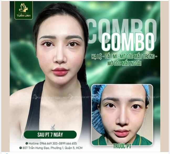 '' Thổi hồn'' cho gương mặt xinh tươi, thanh tú, đẹp rạng ngời.