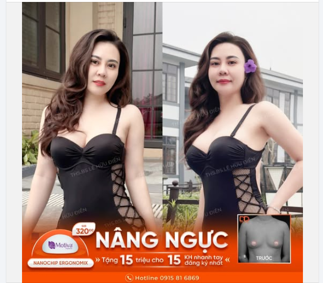 MUỐN BODY XỊN – PHẢI CÓ V1 ĐỈNH